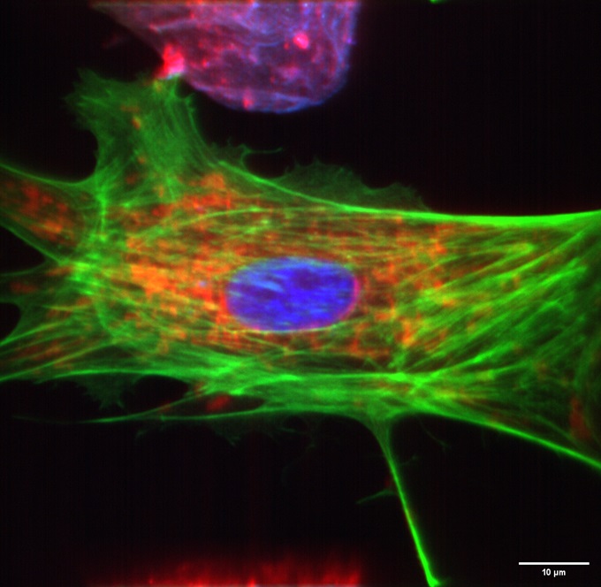 BPAE cells #1, SIMSCOP L series, 60X objective lens NA 1.2